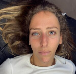 הרמת ריסים בהריון