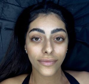 הרמת ריסים משרד הבריאות